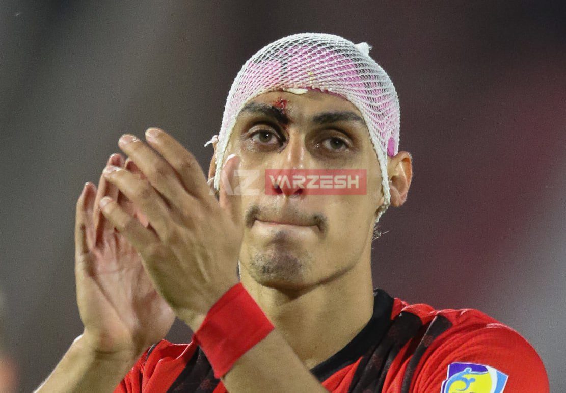 نادری صد را با خون نوشت!