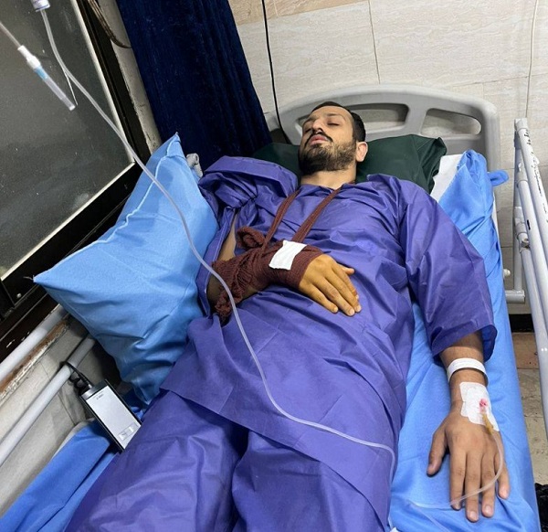 عبدی و دستی که شکست